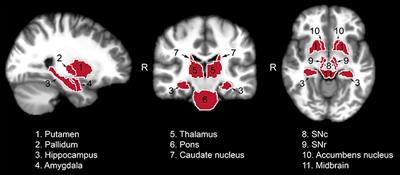 Multi-modal Brain MRI in Subjects with PD and iRBD